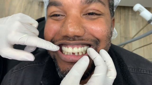Houston Cosmetic Dentist ...How to close those gaps without braces affordably!! смотреть онлайн