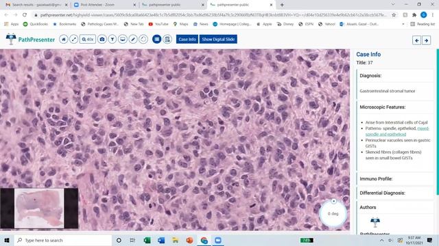 Day 6: GI Dr Alsaati: Path Presenter cases 31-50 смотреть онлайн