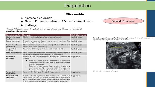 Placenta 3 смотреть онлайн