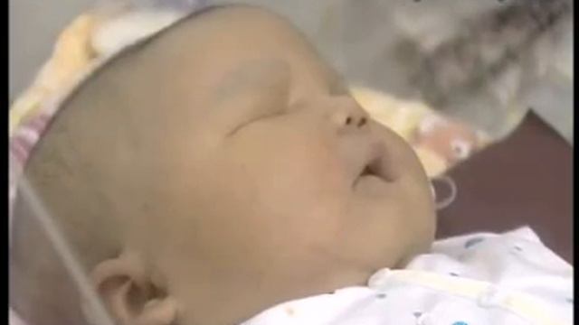 Spotlight: Massive Baby Born смотреть онлайн