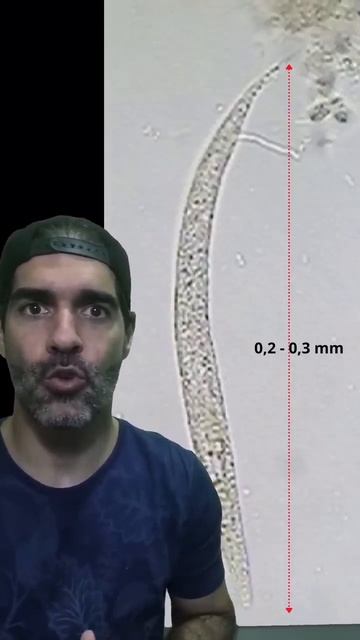 O VERME que anda em baixo da pele | pidobiologia #shorts смотреть онлайн