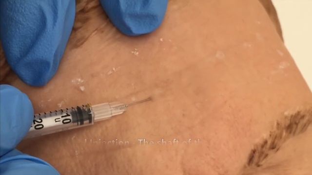 Different depth of injections смотреть онлайн