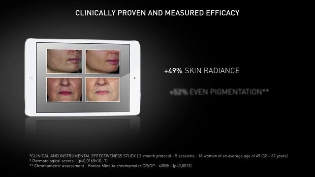 MESOTERAPIA FRANCESA - FILORGA NCTF 135 HA смотреть онлайн