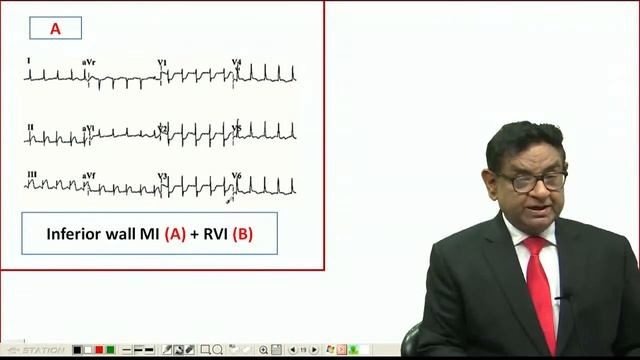 CORONARY ARTERY DISEASE PART 6 смотреть онлайн