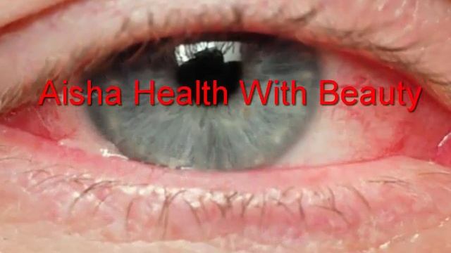 How to Get Rid of a Styes; Home Remedies and Treatments || Aankh Ke Dano Ka Ilaj смотреть онлайн