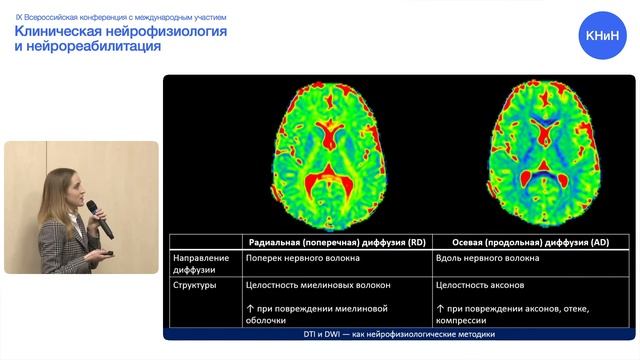 DTI и DWI — как нейрофизиологические методики смотреть онлайн