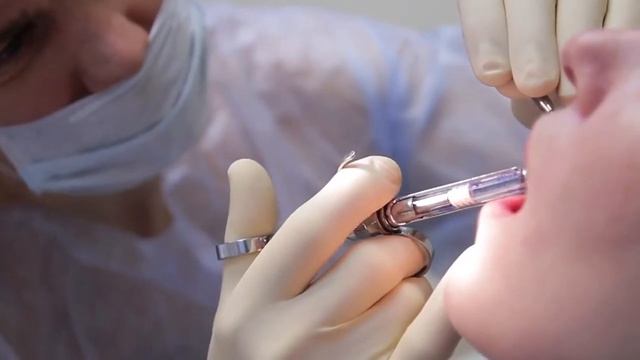 Имплантация и протезирование зубов ALL ON 4 смотреть онлайн