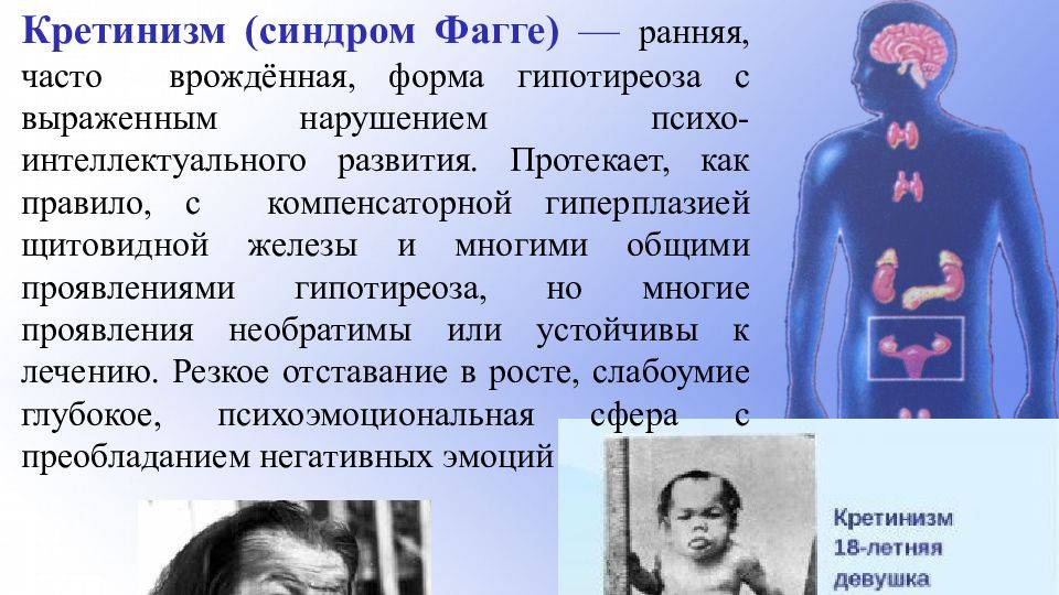 Болезнь Фагге смотреть онлайн