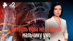 Питбуль покусал мальчика — у пса уже три жертвы и его не могут остановить / РЕН Новости
