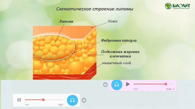 #липома Спрашивали- Отвечаем смотреть онлайн