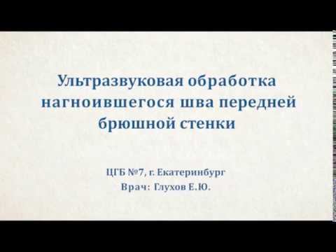 Ультразвуковая обработка нагноившегося шва передней брюшной стенки