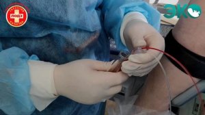 Трансвагинальная пункция фолликулов