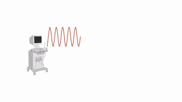 Assessing tricuspid valve stenosis смотреть онлайн
