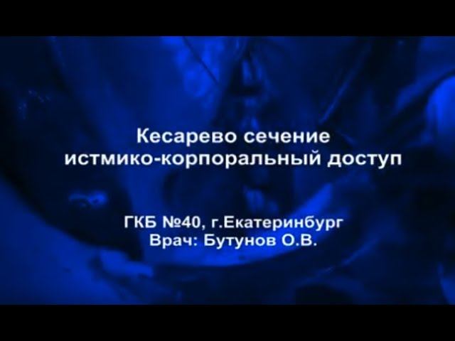 Кесарево сечение истмико корпоральный доступ