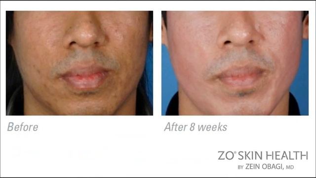 ZO Skin Health Video Loop With Music смотреть онлайн