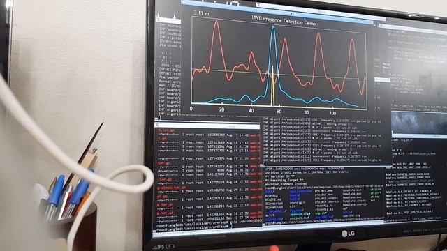 20200902 050920 respiration with radar 1.2m high смотреть онлайн