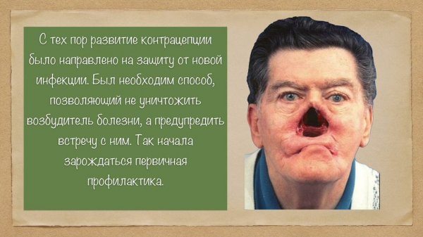 История секса. Как предохранялись наши предки. https://dzen.ru/video/watch/63c56fbd932f3e39b159bc27