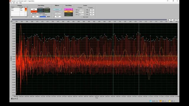 In-depth ECG Editing for High-Frequency HRV - Webinar September 21, 2021 смотреть онлайн