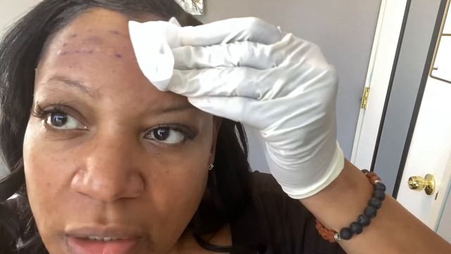 Hyaluron Pen session on forehead lines #HyaluronPen #fine lines # Hyaluron acid #filler #botox смотреть онлайн