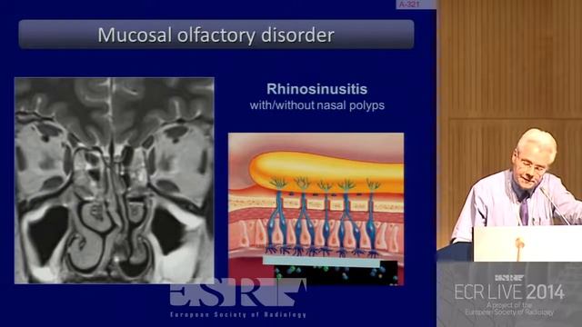 Imaging of anterior cranial fossa - HD [Basic Radiology] смотреть онлайн
