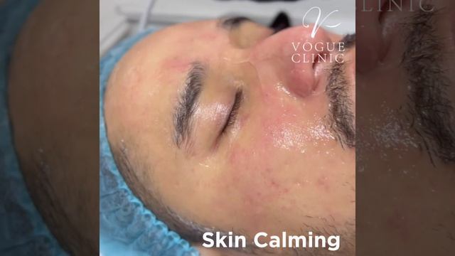 Vogue aquapeel therapy смотреть онлайн