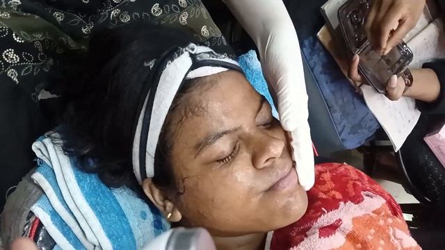 Hydra Facial all process 🫣 смотреть онлайн