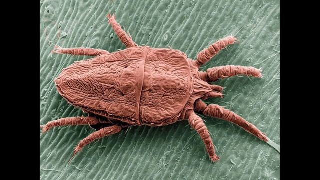 Scrub Typhus смотреть онлайн