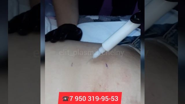 ХОЛОДНАЯ ПЛАЗМА, ОБУЧЕНИЕ, НАБЕРЕЖНЫЕ ЧЕЛНЫ. смотреть онлайн