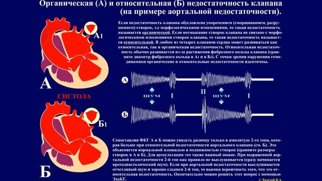 Решаем задачи по пропедевтике внутренних болезней. Задача-9. смотреть онлайн