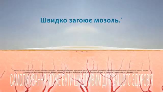 Гидроколоидная технология пластыря COMPEED® смотреть онлайн