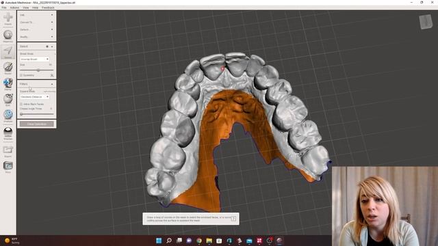 BASIC DENTAL MODEL TRIMMING IN MESHMIXER смотреть онлайн