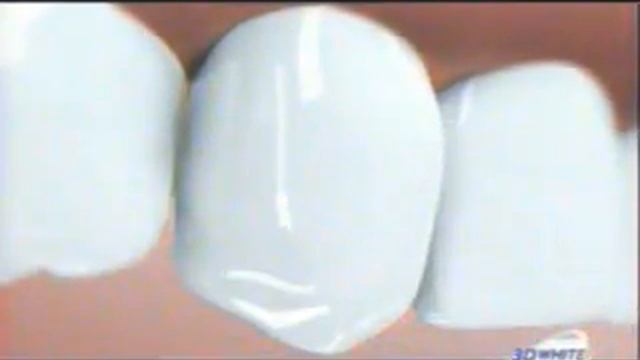 Реклама Procter & Gamble