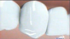 Реклама Procter & Gamble