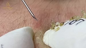 Relax every day with Hana Spa Beauty #529