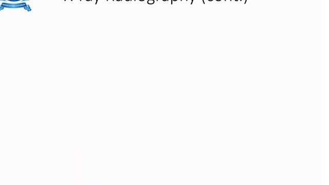 #ME8097 UNIT V NON DESTRUCTIVE TESTING METHODS PART 2 смотреть онлайн