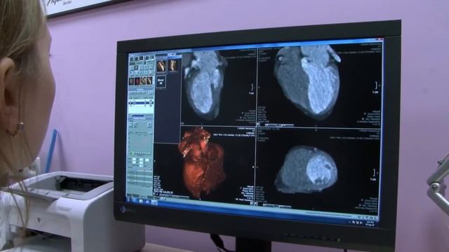 REALIZA UNA ESPECIALIDAD MÉDICA EN CIRUGÍA CARDIOVASCULAR | Rusia | Como estudiar medicina en Rusia смотреть онлайн