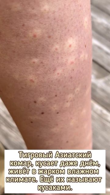 Местный зло@ебучий биологический паразит #комар #паразиты #море #туапсе #туапсинскийрайон смотреть онлайн