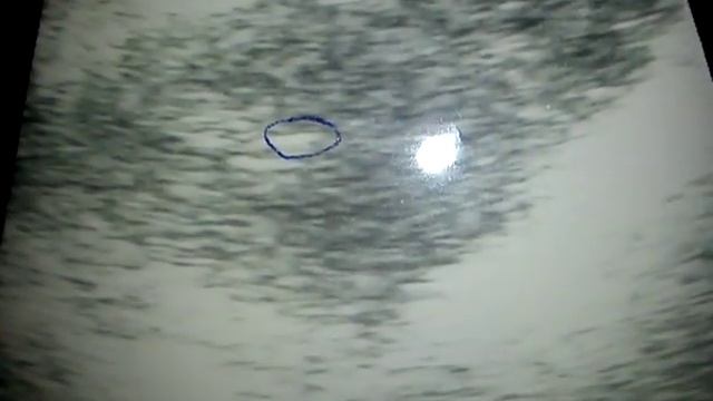 Ultrasound - Pic of the baby смотреть онлайн