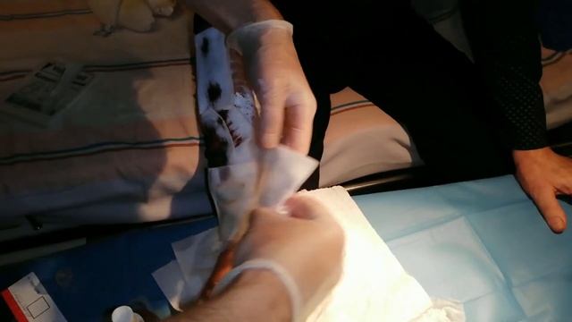 Larwy LUCILIA SERICATA i TERAPIA PODCIŚNIENIOWA - Case Study смотреть онлайн