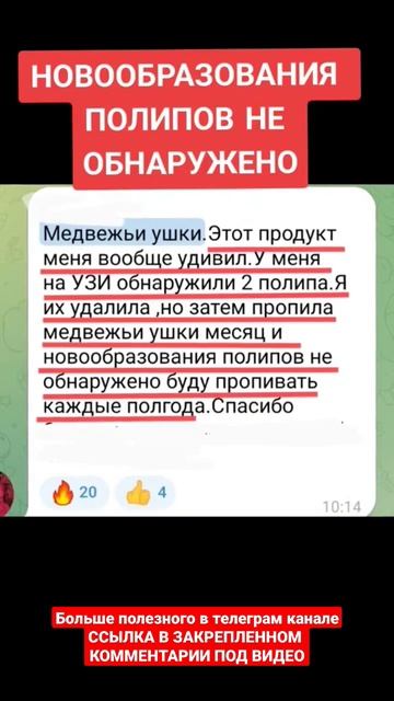НОВООБРАЗОВАНИЯ ПОЛИПОВ НЕ ОБНАРУЖЕНО смотреть онлайн