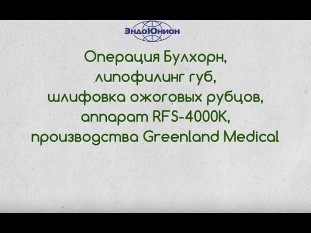Операция Булхорн и иссечение рубцов на радиоволновом аппарате Greenland Medical