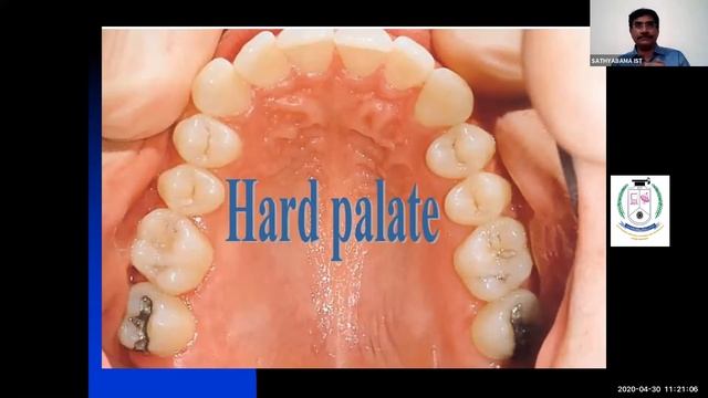 ORAL HISTOLOGY - Dr.Thaymanavan смотреть онлайн