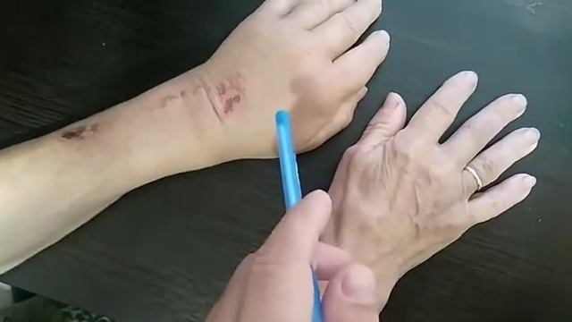 Работа с артрозом, ревматоидным артритом. Солодовникова Е. С смотреть онлайн