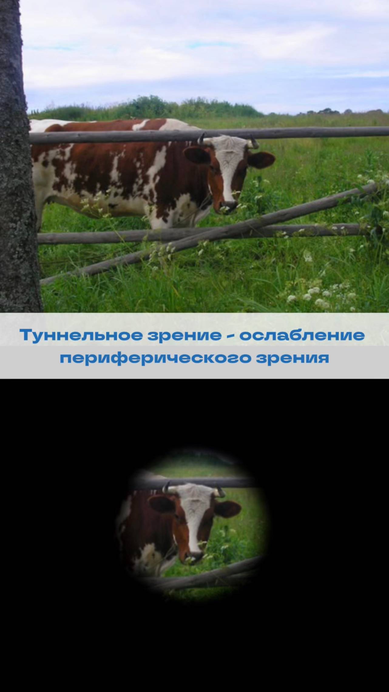 Пропало боковое зрение? Что делать? смотреть онлайн