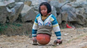 15 лет назад фото девочки на "баскетбольном мяче" облетело весь мир, посмотрите кем она стала сейчас