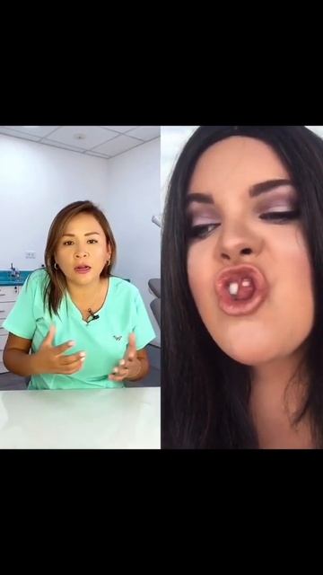 ¿Otra moda? 😠 #diastema #brackets #carilladental #Sonrisasegura #shorts смотреть онлайн