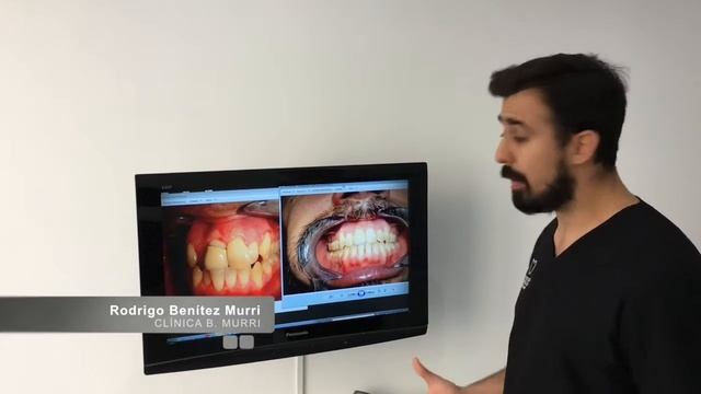 Técnica Brackets Damon - Doctores B.Murri смотреть онлайн