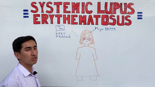 Sistemali Qizil Yugurik | #SLE #СКВ #imedteam смотреть онлайн