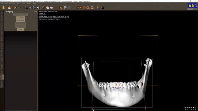 DDS Pro 008 Surgery bone cutting смотреть онлайн