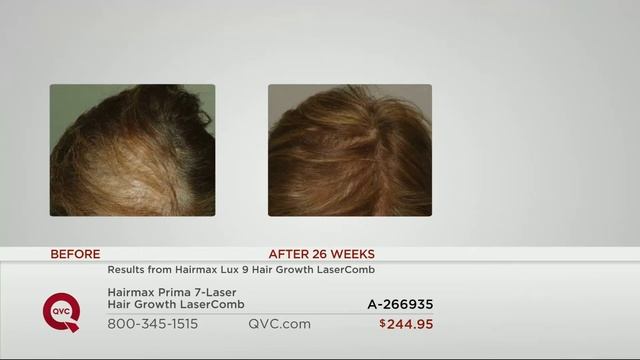 Hairmax Prima 7-Laser Hair Growth LaserComb With Mary Beth Roe